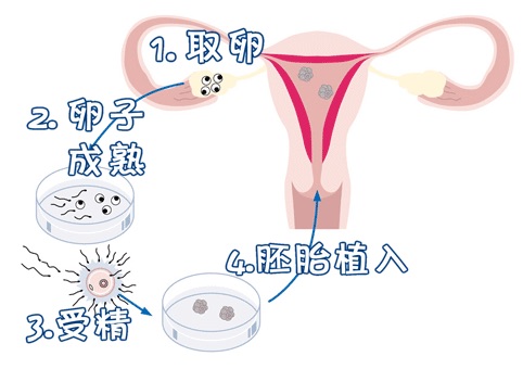 供卵代怀价格